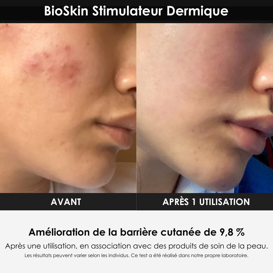 BioSkin Stimulateur Dermique