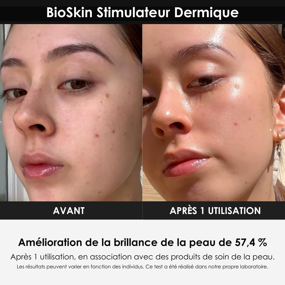 BioSkin Stimulateur Dermique