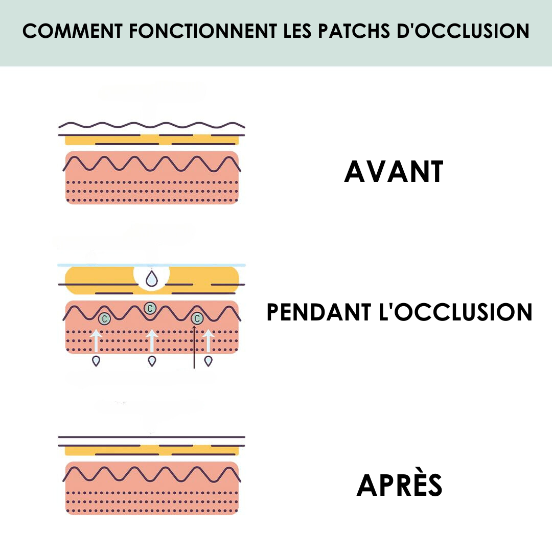 SKEENCARE™ Patch frontal